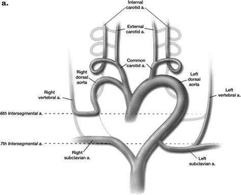Subclavian Artery Vertebral Artery