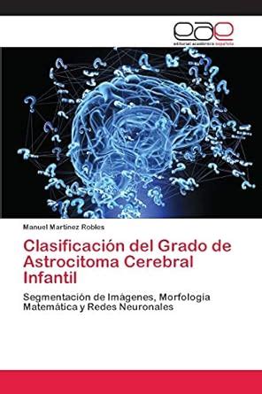Buy Clasificación del Grado de Astrocitoma Cerebral Infantil Book ...