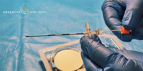 Image result for Lumbar Disc Injection