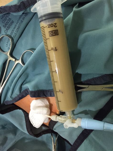 Carbuncle Drainage Procedure 的图像结果