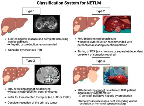 Defining a New Classification System for the Surgical Management of ...