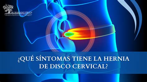 ¿Qué debo hacer si tengo una hernia discal lumbar? - Dr. Mariano de Jesús Virgen León