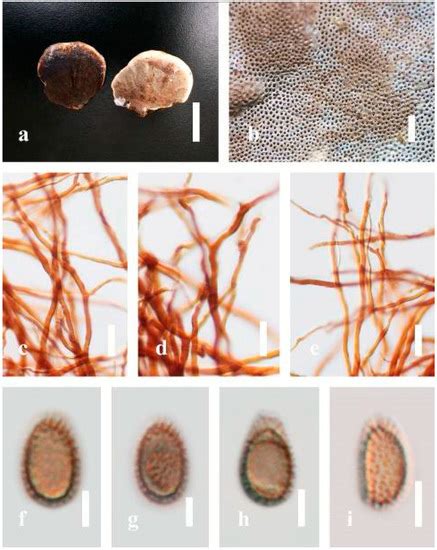 JoF | Special Issue : Diversity and Classification of Environmental Fungi