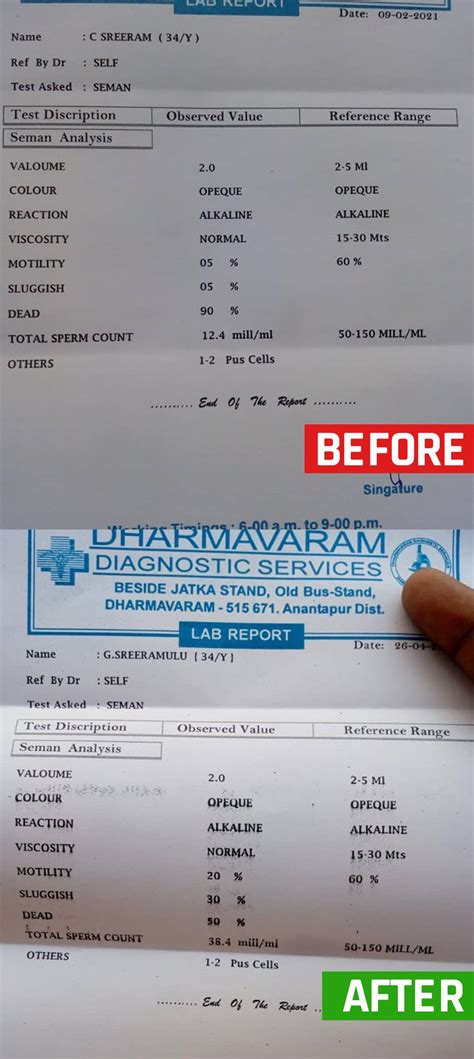 Ayurvedic Oligospermia Treatment | Low Sperm Count Treatment