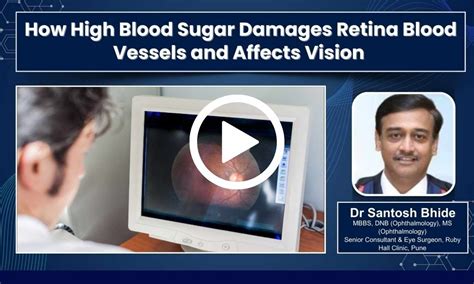 How High Blood Sugar Damages Retina Blood Vessels and Affects Vision ...