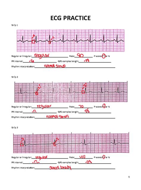 EKG Practice Handout - ECG PRACTICE Strip 1 Regular or irregular: Rate ...