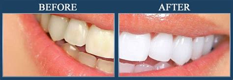 Gallery - Little Smiles