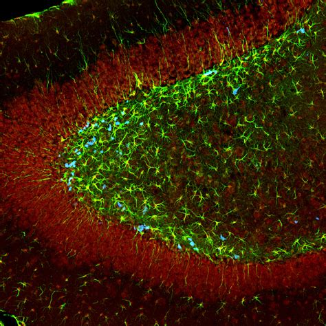 How to Grow Brain Cells - Nootropics & Lifestyle Tips for Neurogenesis - Supplements in Review