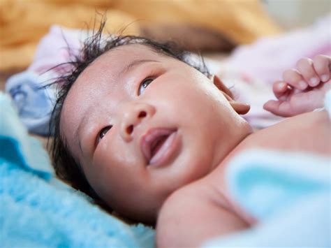 Periorbital (preseptal) cellulitis: Swelling under one eye | BabyCenter