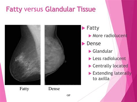 PPT - Anatomy, Physiology, and Pathology of the Breast PowerPoint ...