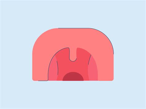 Cobblestone Throat: Causes and Treatment