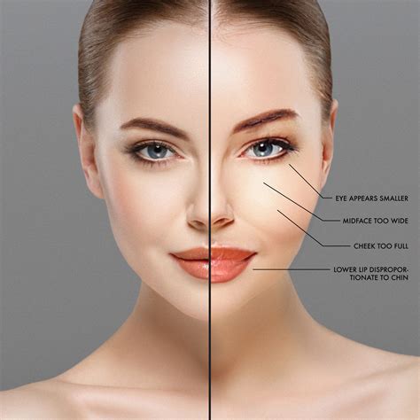 "PILLOW FACE" - LASAIR AESTHETIC HEALTH