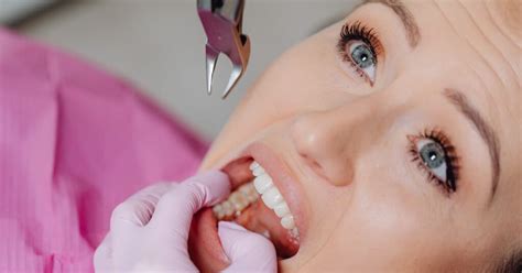 Extracting Abscessed Tooth 的图像结果