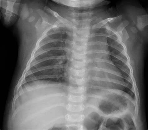 Philips - Unique X-ray image Processing Software