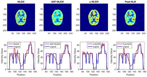A Novel Kernel-Based Regularization Technique for PET Image Reconstruction