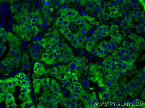Thyroglobulin antibody (60272-1-PBS) | Proteintech