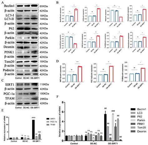 Placental Mesenchymal Stem Cells Alleviate Podocyte Injury in Diabetic ...