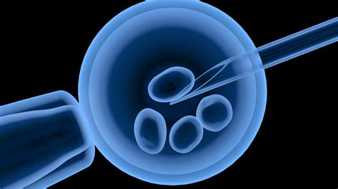 IVF Procedure Explained 的图像结果
