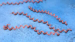 Lyme disease not tied with either Alzheimer's disease or Lewy body ...