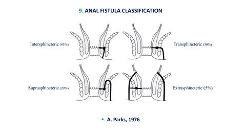 Anorectal abscess and fistula in ano | PPT