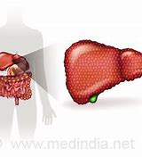 Image result for hepatotoxemia