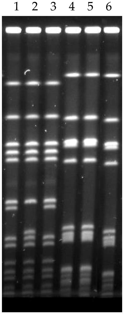 Use of Pulsed-Field Gel Electrophoresis to Determine the Source of ...