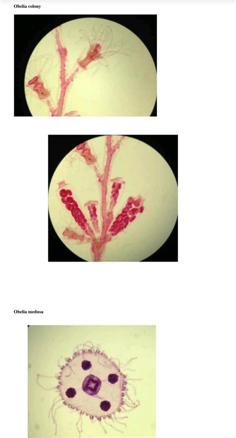 Obelia Slide