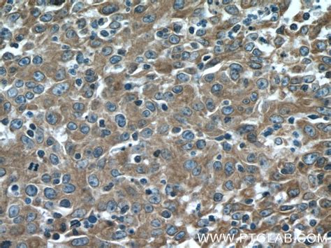Cytokeratin 18 antibody (18708-1-AP) | Proteintech