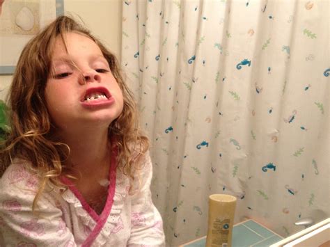 Image result for Lost Tooth