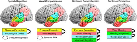 Image result for Conduction Aphasia