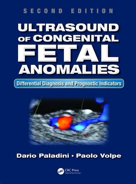 Buy Ultrasound of Congenital Fetal Anomalies: Differential Diagnosis ...