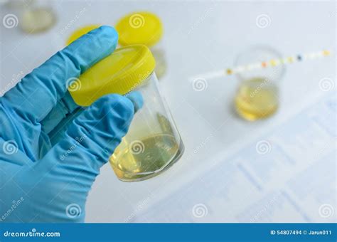 Urine sample stock photo. Image of medical, medicine - 54807494
