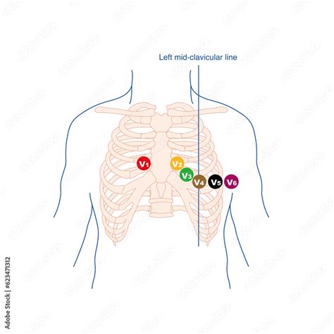 Image result for Lead Optimization Mapper Algorithm