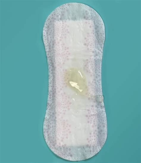 Compare Vaginal Discharge color to identify STD - STD Testing Near Me