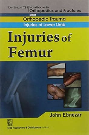 John Ebnezar CBS Handbooks in Orthopedics and Fractures: Orthopedic Tr