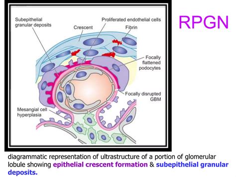 The KIDNEY: Rapidly Progressive Glomerulonephritis | PPTX