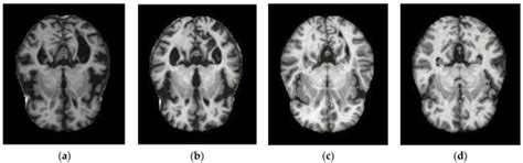 HTLML: Hybrid AI Based Model for Detection of Alzheimer’s Disease