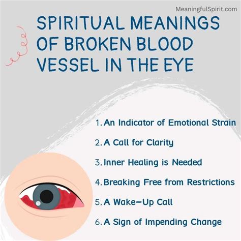 10 Spiritual Meanings of Broken Blood Vessel In The Eye - Meaningful Spirit