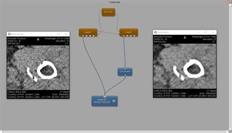 Image result for MeVisLab Features