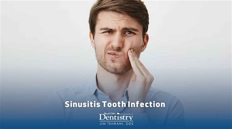 Sinusitis Tooth Infection - Beach Cities Dentistry