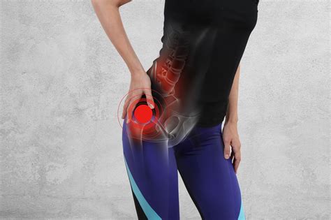 Trochanteric Bursitis - Causes, Symptoms, And Treatment Options
