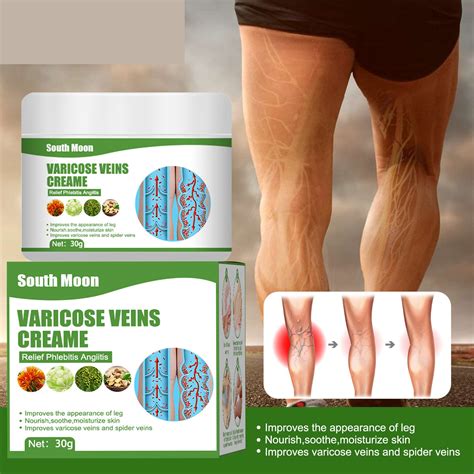 Blue Veins Bulging, Pain Relief, Leg Massage Cream (Pack of 2 ...