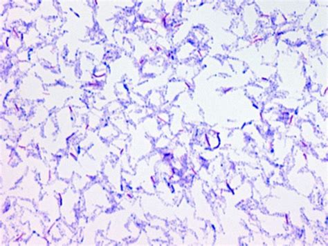 Bacillus Megaterium Acid Fast Stain