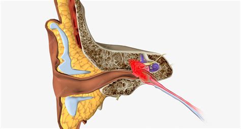 Premium Photo | Acute otitis media is an infection and inflammation of the middle ear usually ...