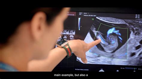 Image result for Fetalscreen II