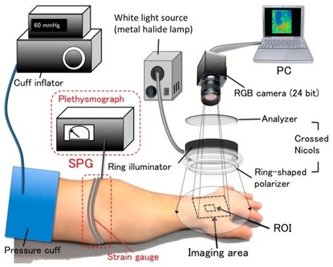 Visualization of Venous Compliance of Superficial Veins Using Non ...