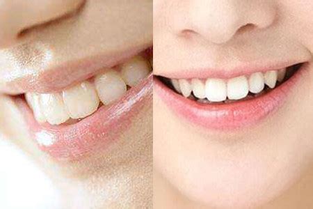 【图】牙齿松动可以修复吗 你的口腔要护理_牙齿_女物美容网|nvwu.com