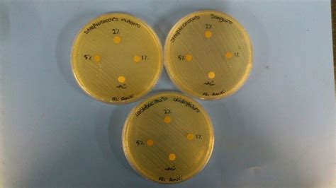 Agar Disc Diffusion Method 的图像结果