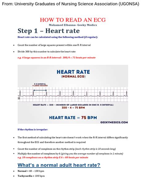 Normal ECG Read Out 的图像结果