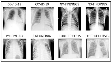 Diagnostics | Free Full-Text | Joint Diagnosis of Pneumonia, COVID-19 ...